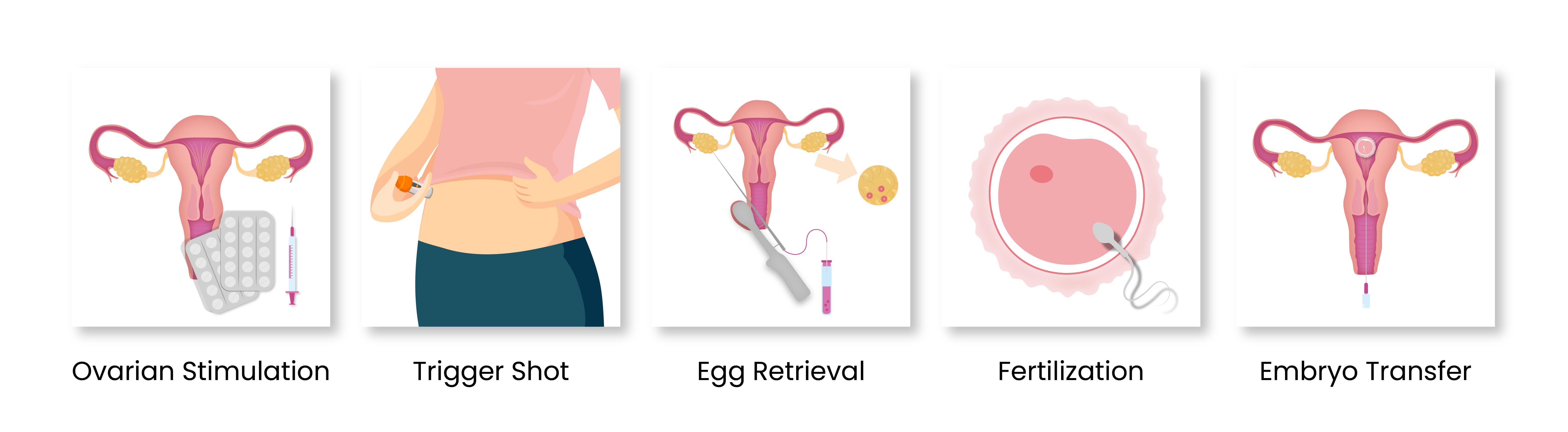 how-ivf-work