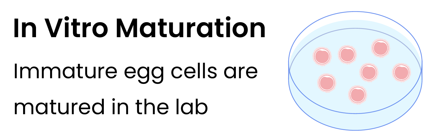 in-vitro-maturation